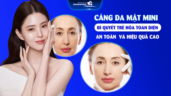 Căng da mặt mini
