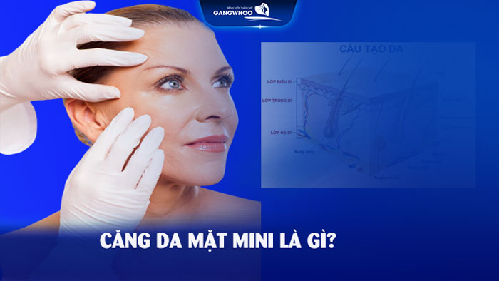 Căng da mặt mini