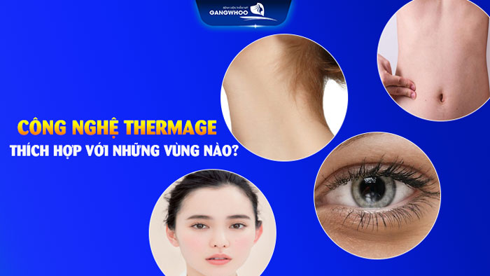 Căng da mặt thermage