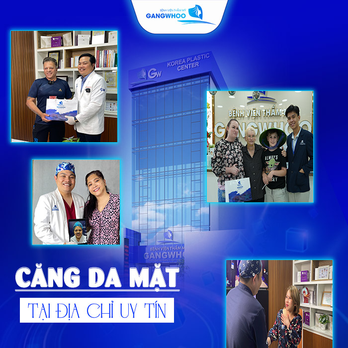 Căng Chỉ Da Mặt Giá Bao Nhiêu Tiền