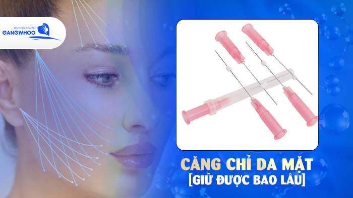 Căng Chỉ Da Mặt Giữ Được Bao Lâu