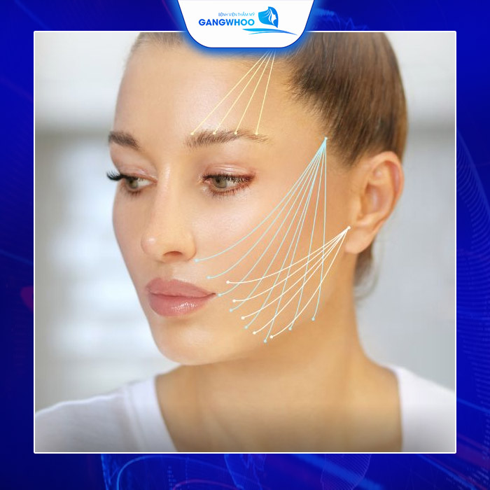 Các Loại Chỉ Căng Da Mặt