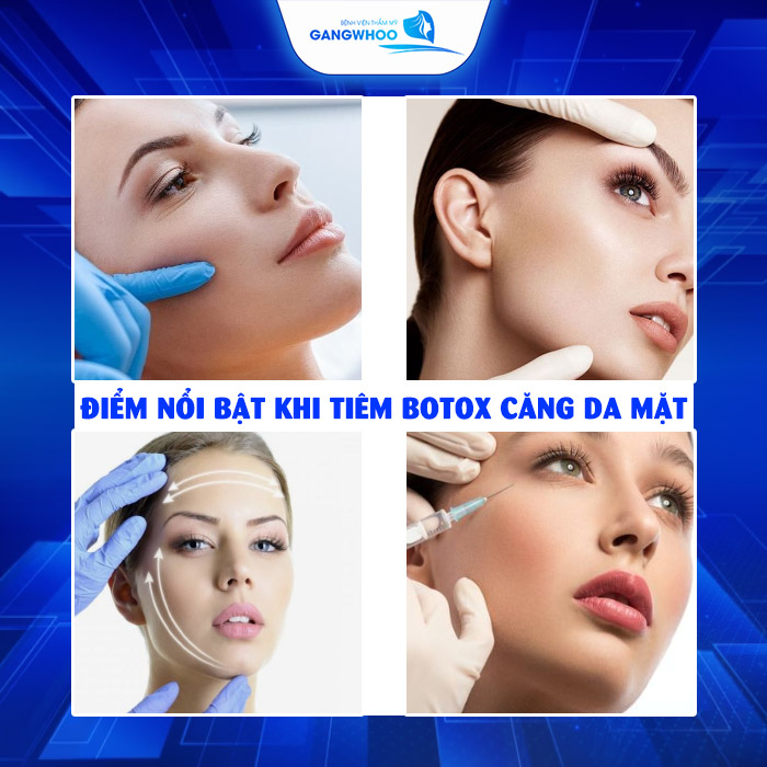 Tiêm Botox Căng Da Mặt