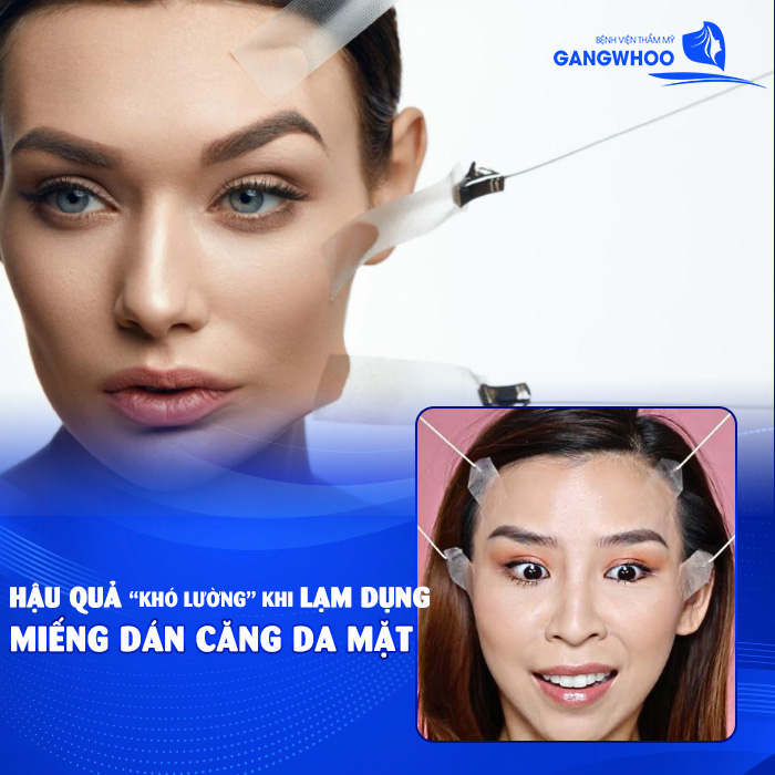 Miếng Dán Căng Da Mặt