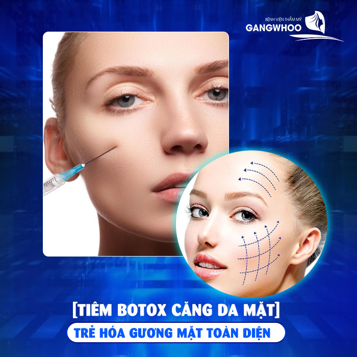 Tiêm Botox Căng Da Mặt