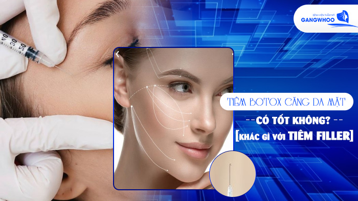 Tiêm Botox Căng Da Mặt