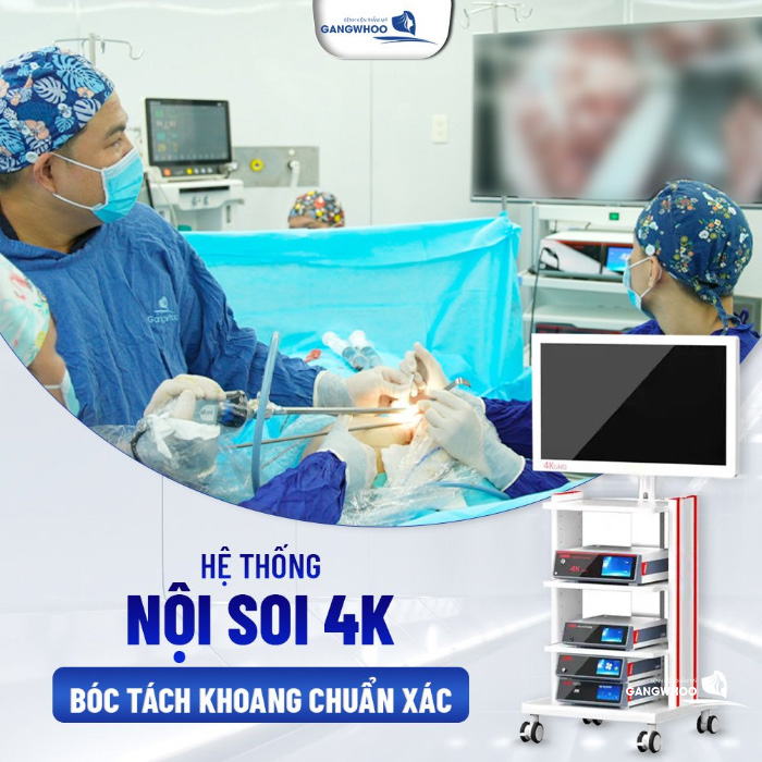 Căng Da Mặt Nội Soi Giá Bao Nhiêu